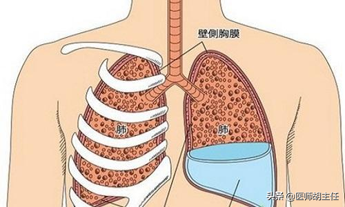 为什么不建议大家做“核磁共振”？你知道原因吗？