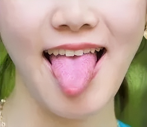 《对手》：硝酸甘油能杀人吗？