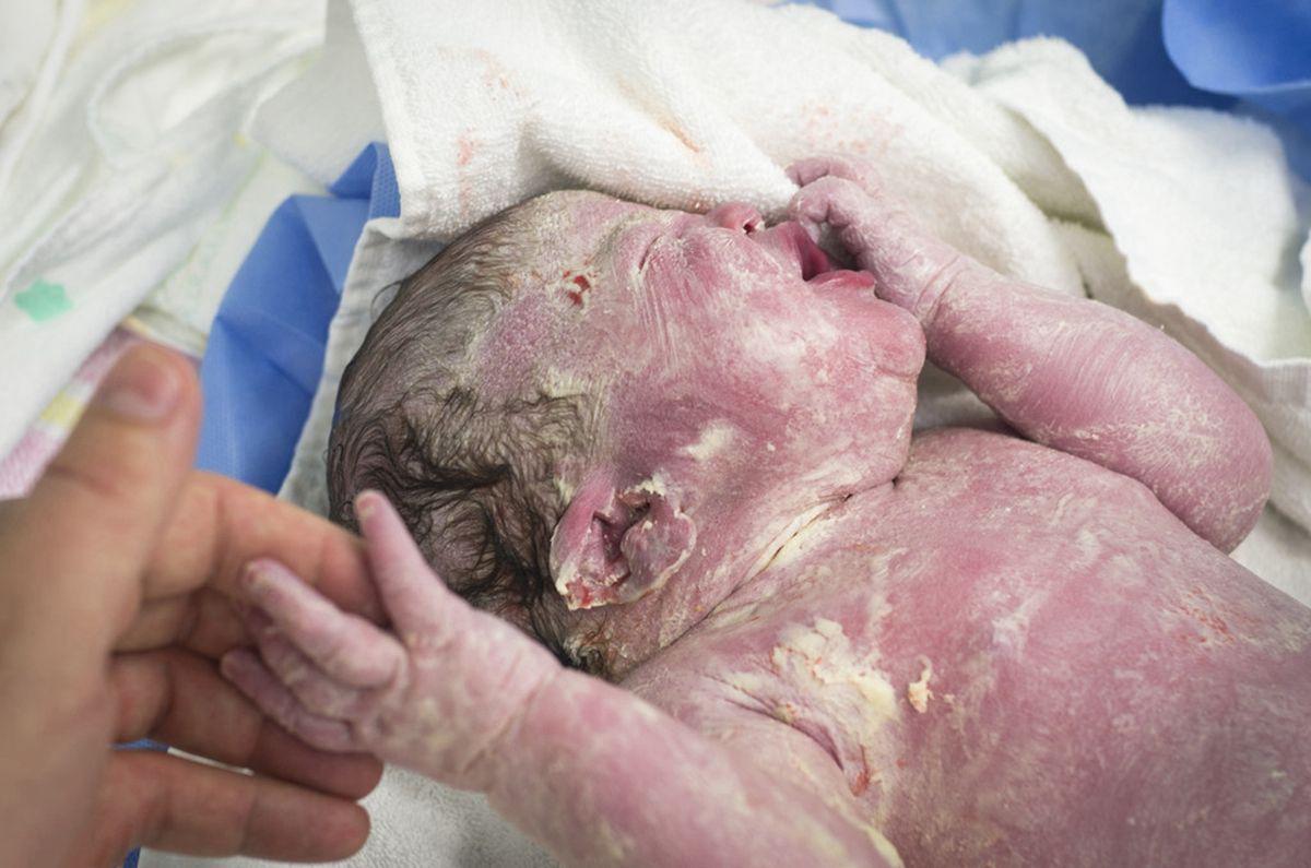 刚出生的女婴下面图片