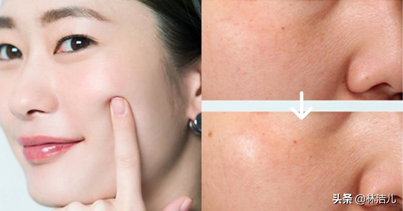 不仅拥有盛世美颜，张雨绮景甜怼脸拍更是零毛孔，皮肤白到发光了