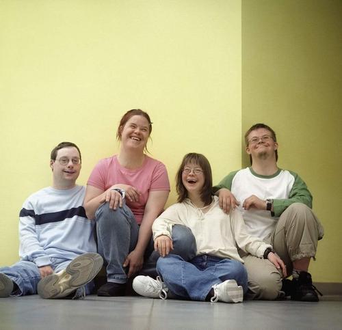 唐氏综合征图片(为什么患有唐氏综合征的人) - 赤虎壹号