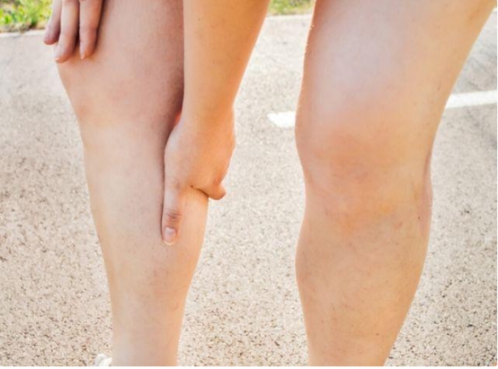 女性宫颈出现病变，腿部可能会发出“预警”，不妨留心观察下