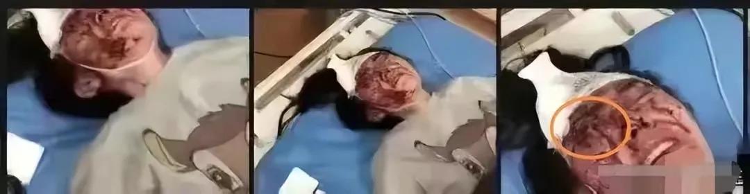 唐山事件大反转：陈继志50万请律师被拒，被害方首次透露重要信息