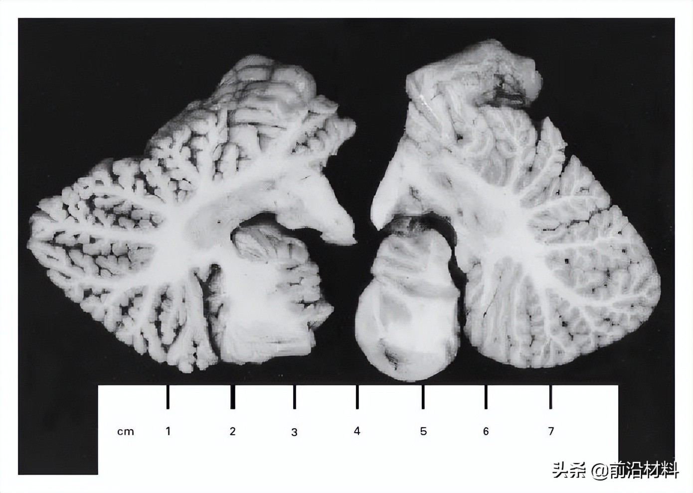 几滴漏在手套上的试剂，杀死了一名博士生导师