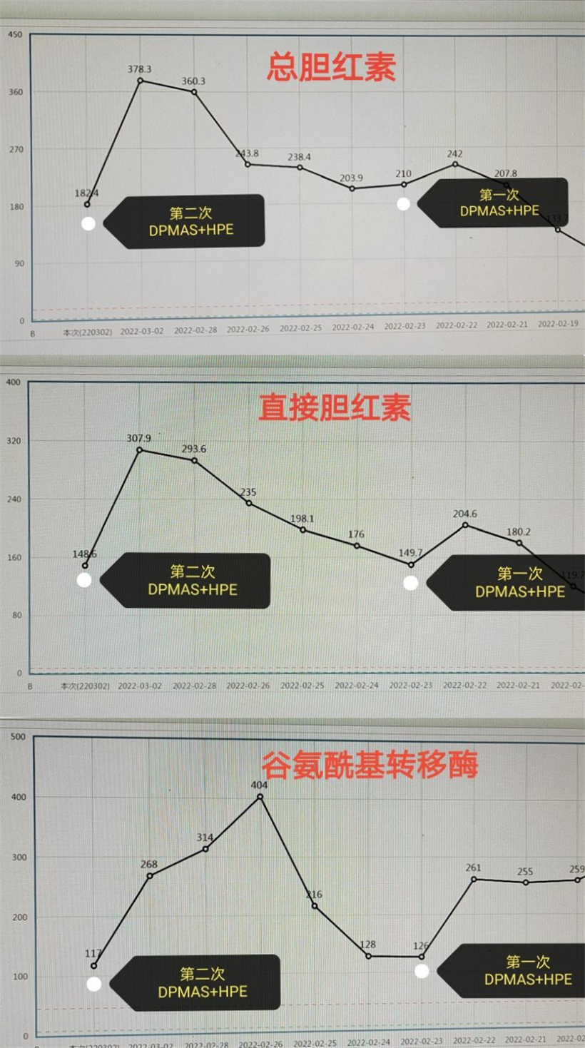 西安市红会医院重症医学科利用人工肝技术救治危重患者