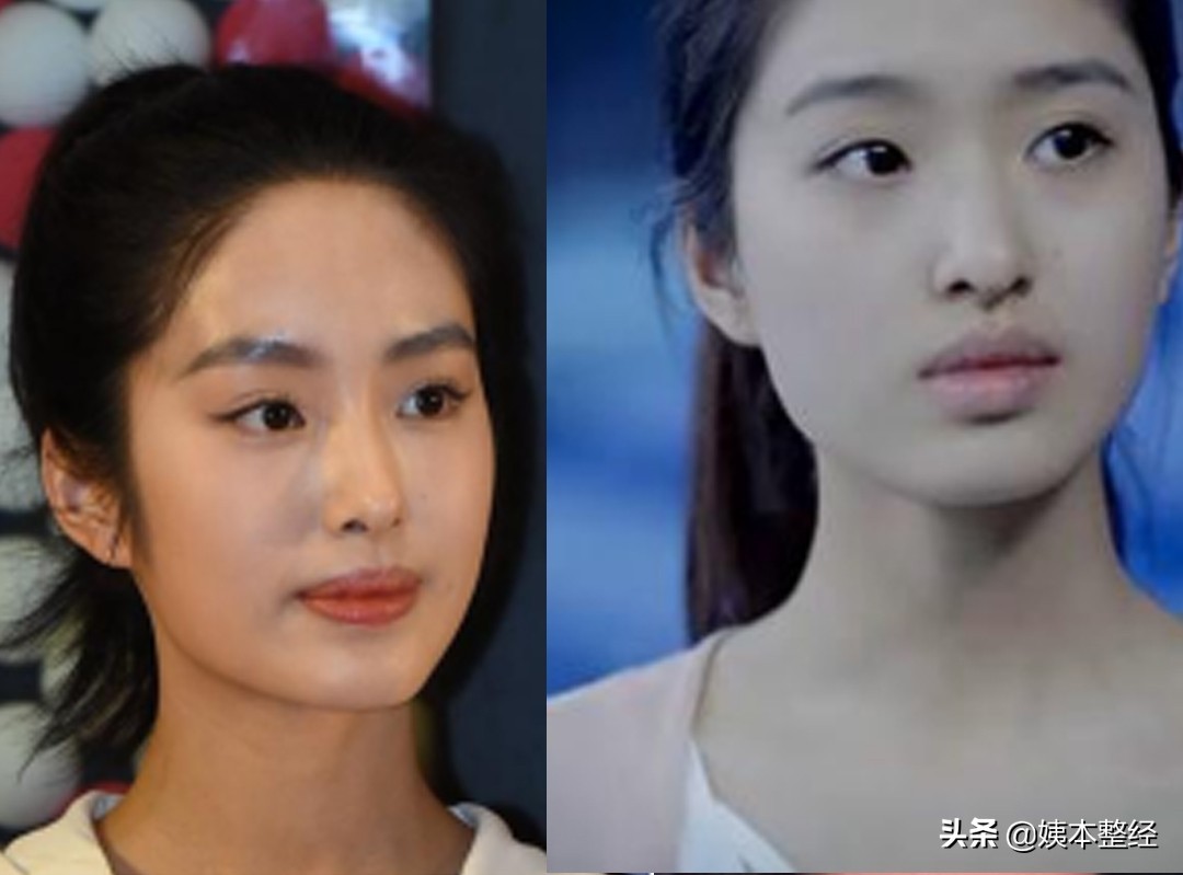 三个显土的长相特征，你中了几个？