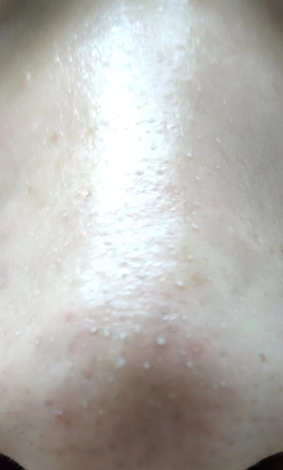 為什么上完粉底液以后，鼻子上有很多白點(diǎn)點(diǎn)？