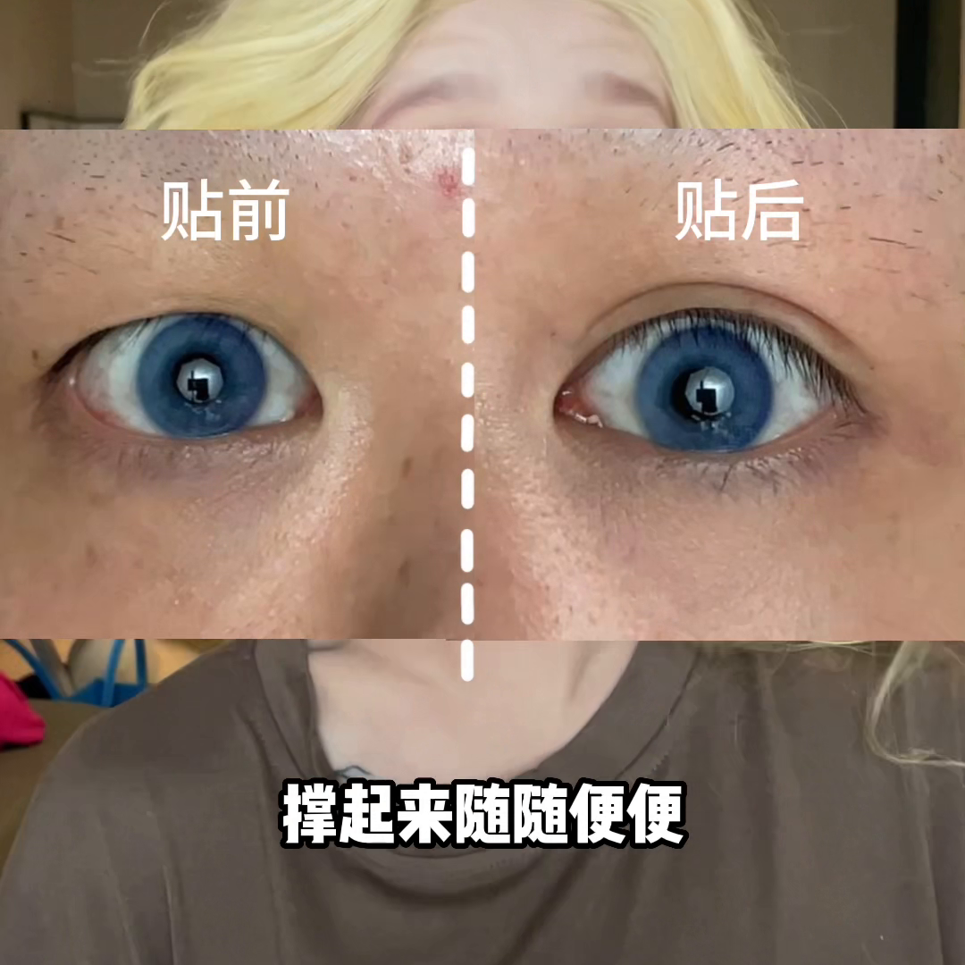 三角眼怎么改善图片