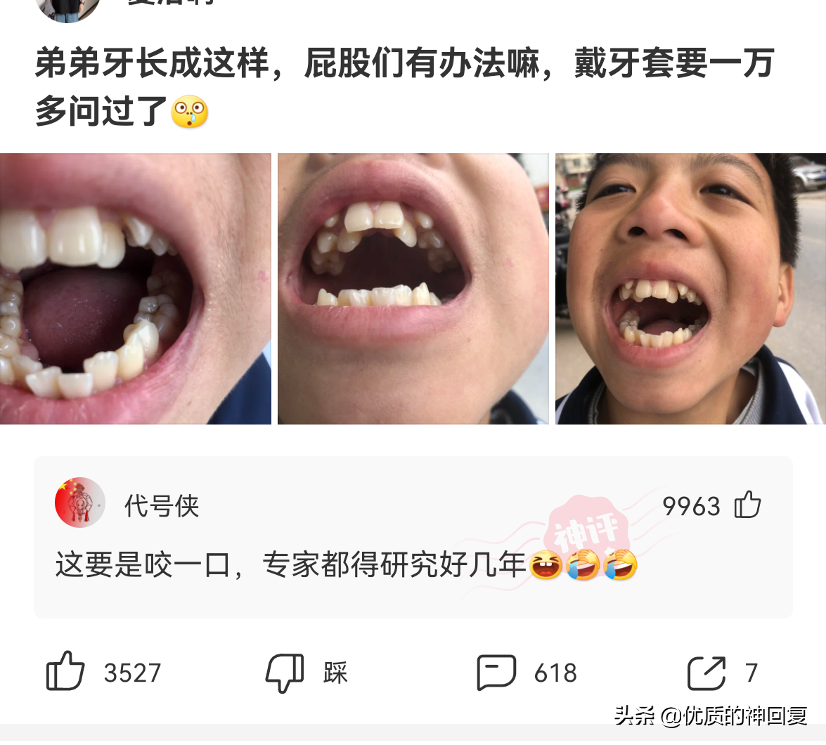 神回复：弟弟的牙齿长成这样，戴牙套要一万多，该怎么办？
