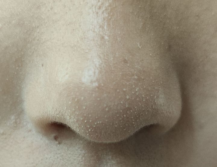 為什么上完粉底液以后，鼻子上有很多白點(diǎn)點(diǎn)？