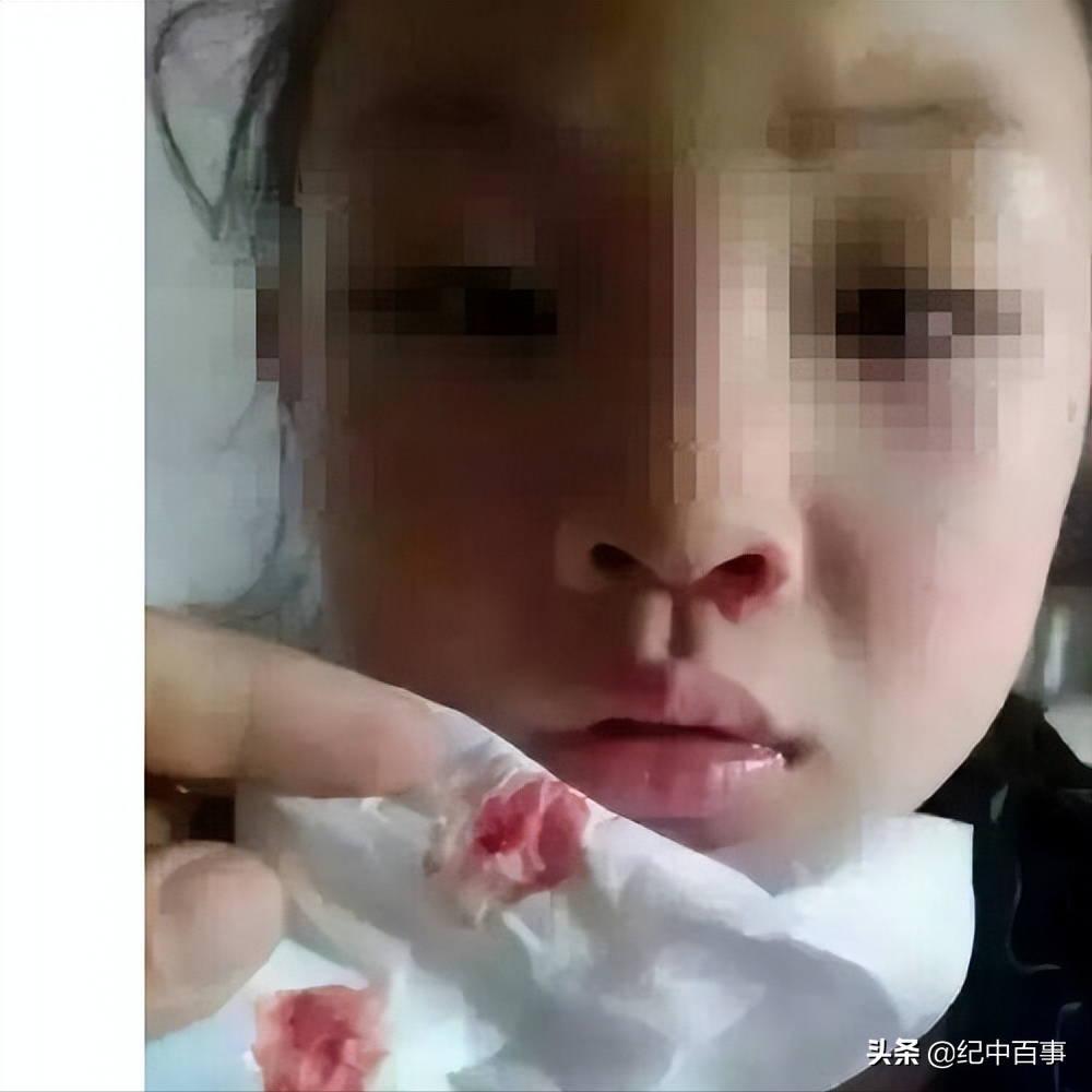 2005年女童身患白血病，为减轻养父负担，偷偷签下放弃治疗协议