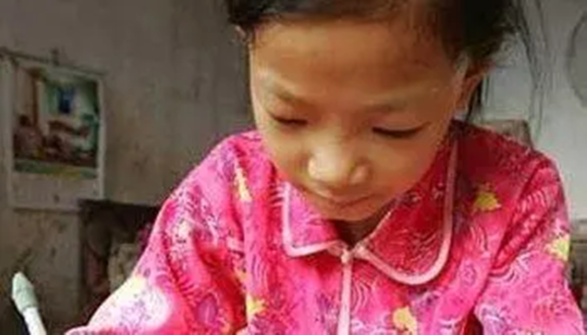 2005年女童身患白血病，为减轻养父负担，偷偷签下放弃治疗协议