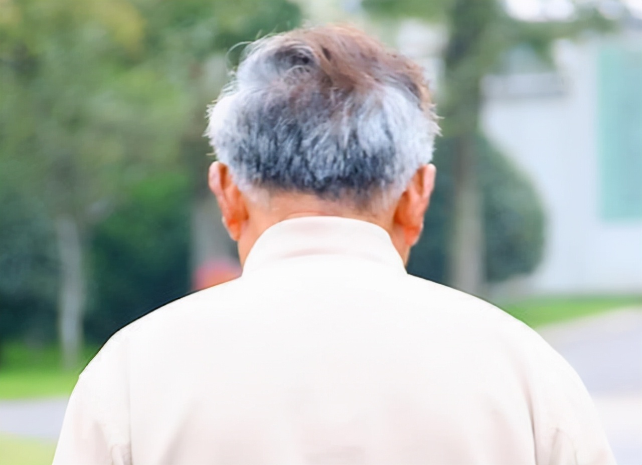 白发长在前额,两鬓,后脑勺,分别有啥含义?早知早好