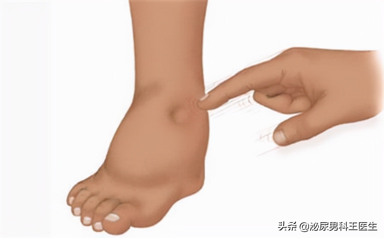 肾好不好，一泡尿就能知晓？若尿液有几种变化，需尽快给肾做检查