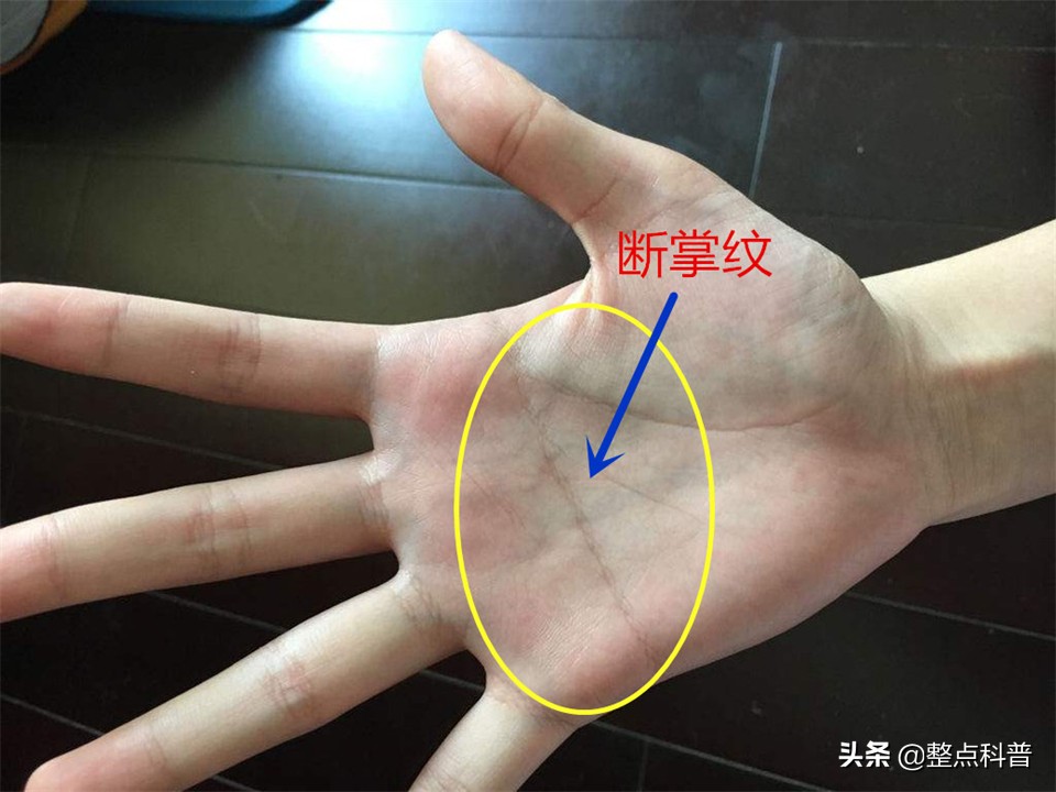 "断掌纹"到底有什么奥秘?