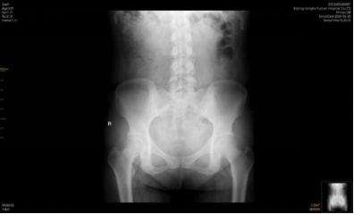 315曝光：6天拿证速成“医师”，产后修复真得小心了