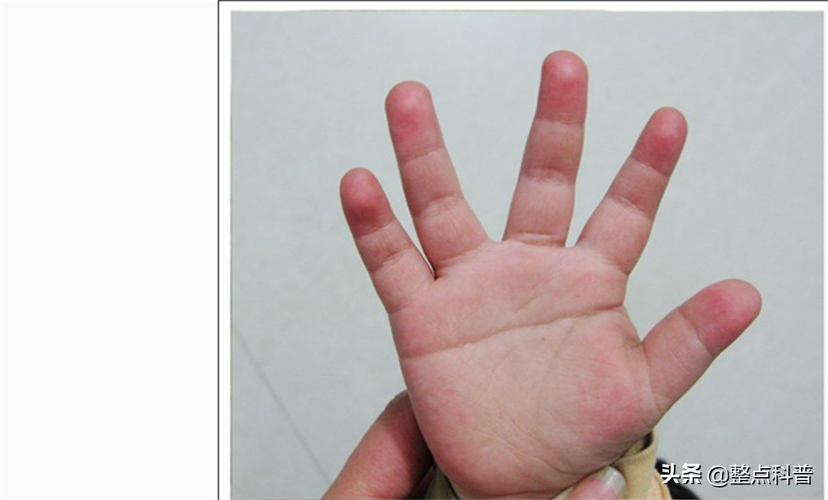 男儿断掌千斤两,女子断掌过房养?"断掌纹"到底有什么奥秘?