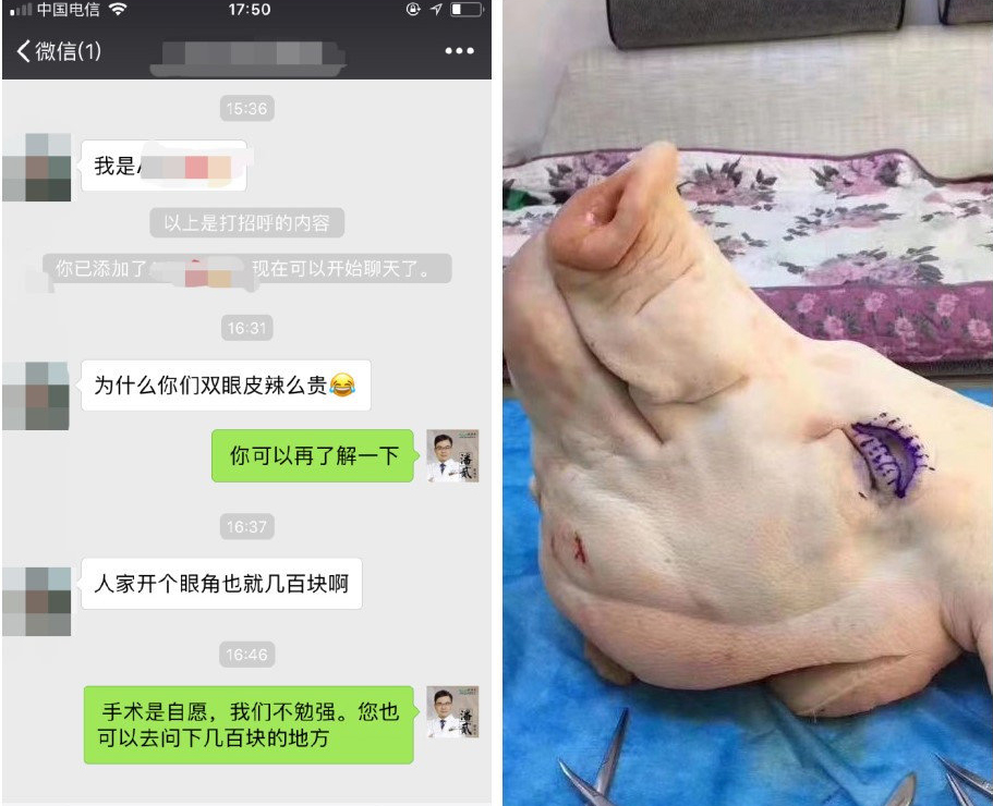 整形美容：不想被练手，割双眼皮花多少钱比较合适？