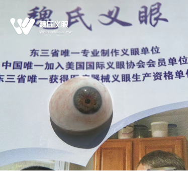 义眼片定制流程