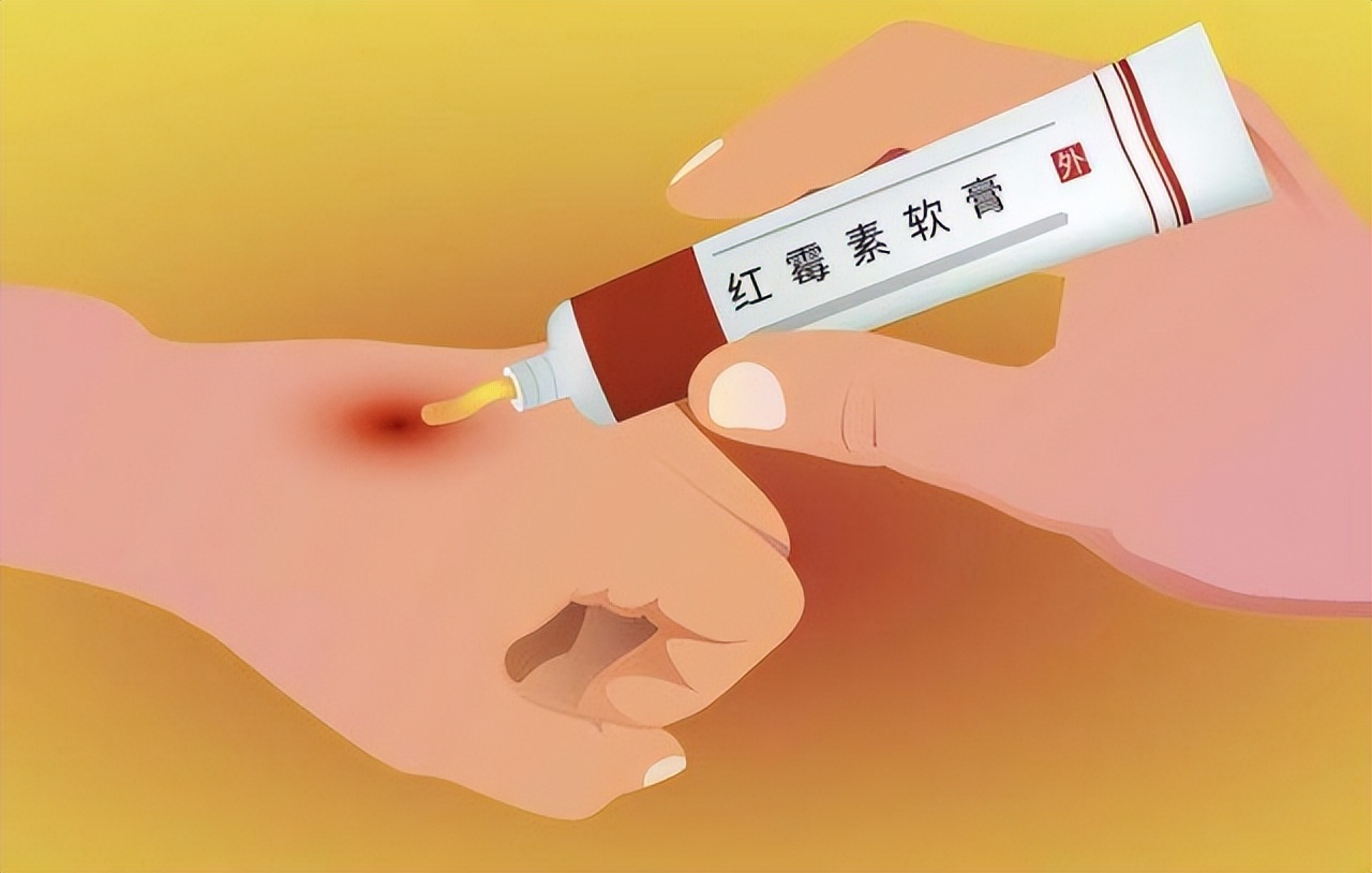 红霉素软膏，在眼部涂两下，会出现什么变化？建议了解一下
