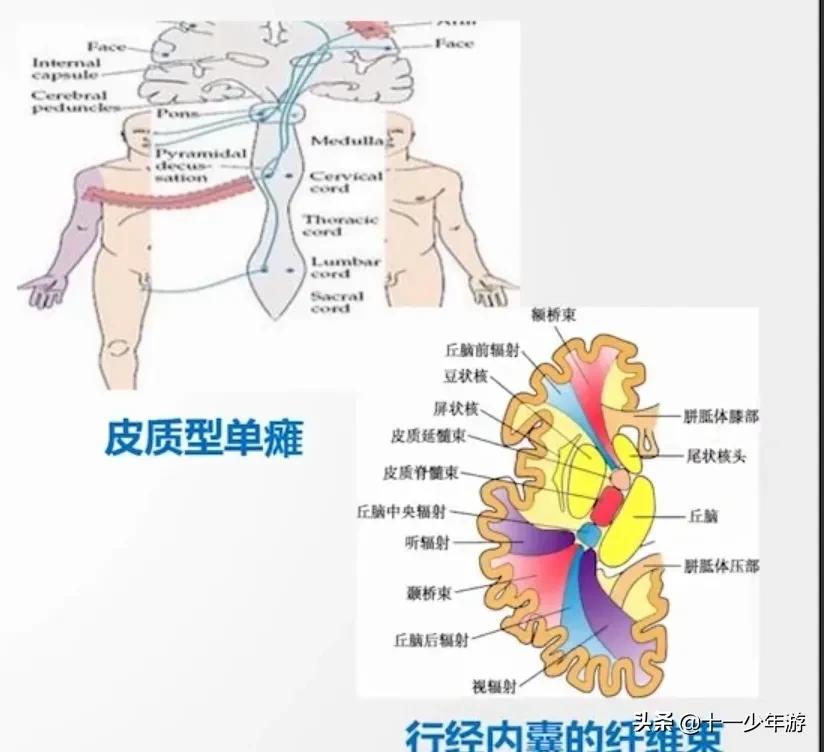 nba被动肌张力包括有哪些(运动系统解剖、生理及损害表现)