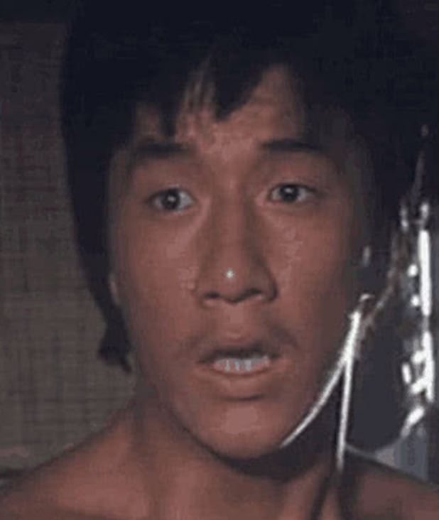 双眼皮如今变成颜值分水岭，有人靠它提升颜值，有人变身悲伤蛙