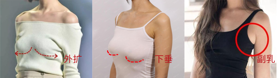 聚攏文胸，女生到底該不該穿聚攏文胸？