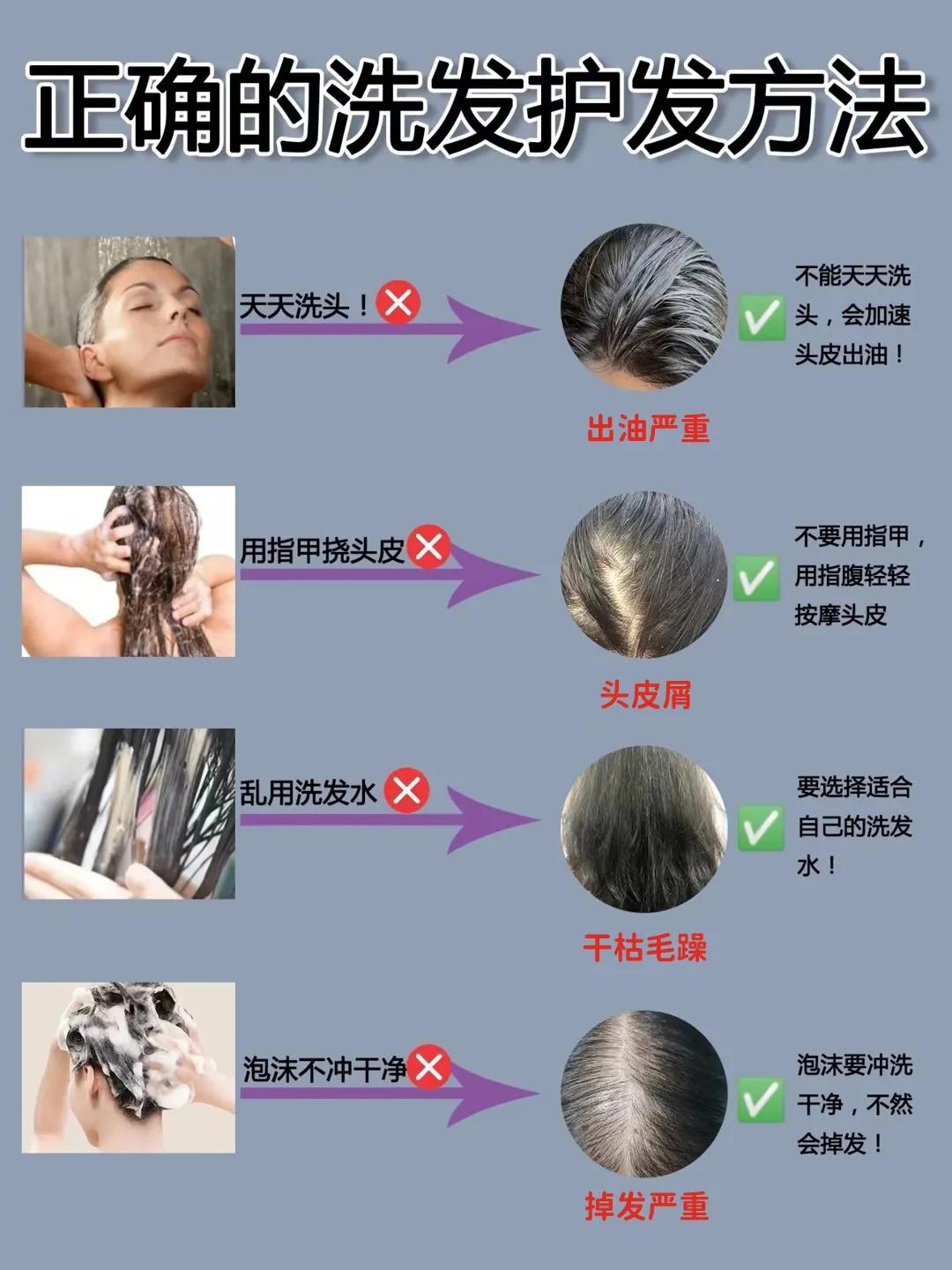 用对洗发水，掉了的发还发水<strong></strong>头发还能在长出来？防脱洗发水里面含什么？
