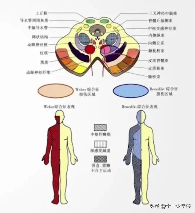 nba被动肌张力包括有哪些(运动系统解剖、生理及损害表现)