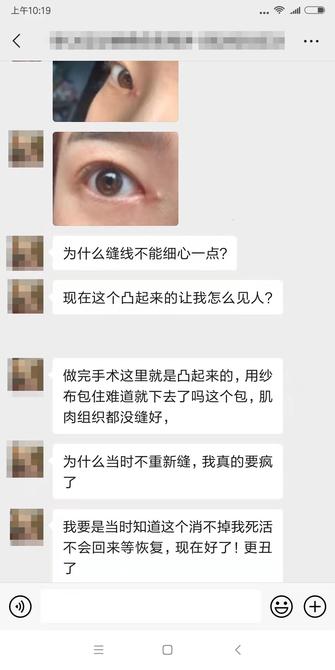 四川女子整容失败：我当初就不应该去开内外眼角，做多了只会变丑