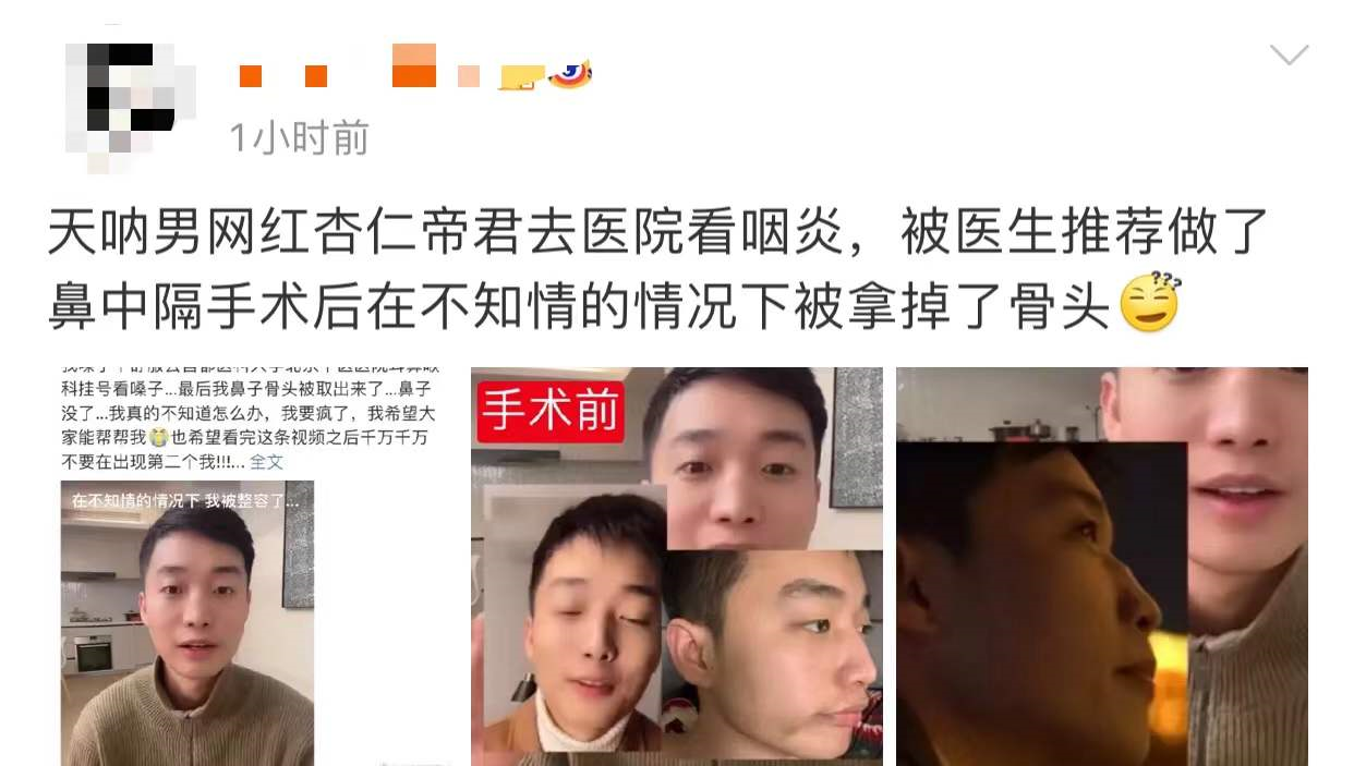 男网红咽喉不适去医院检查，毫不知情被“整容”，鼻子坍塌惨毁容