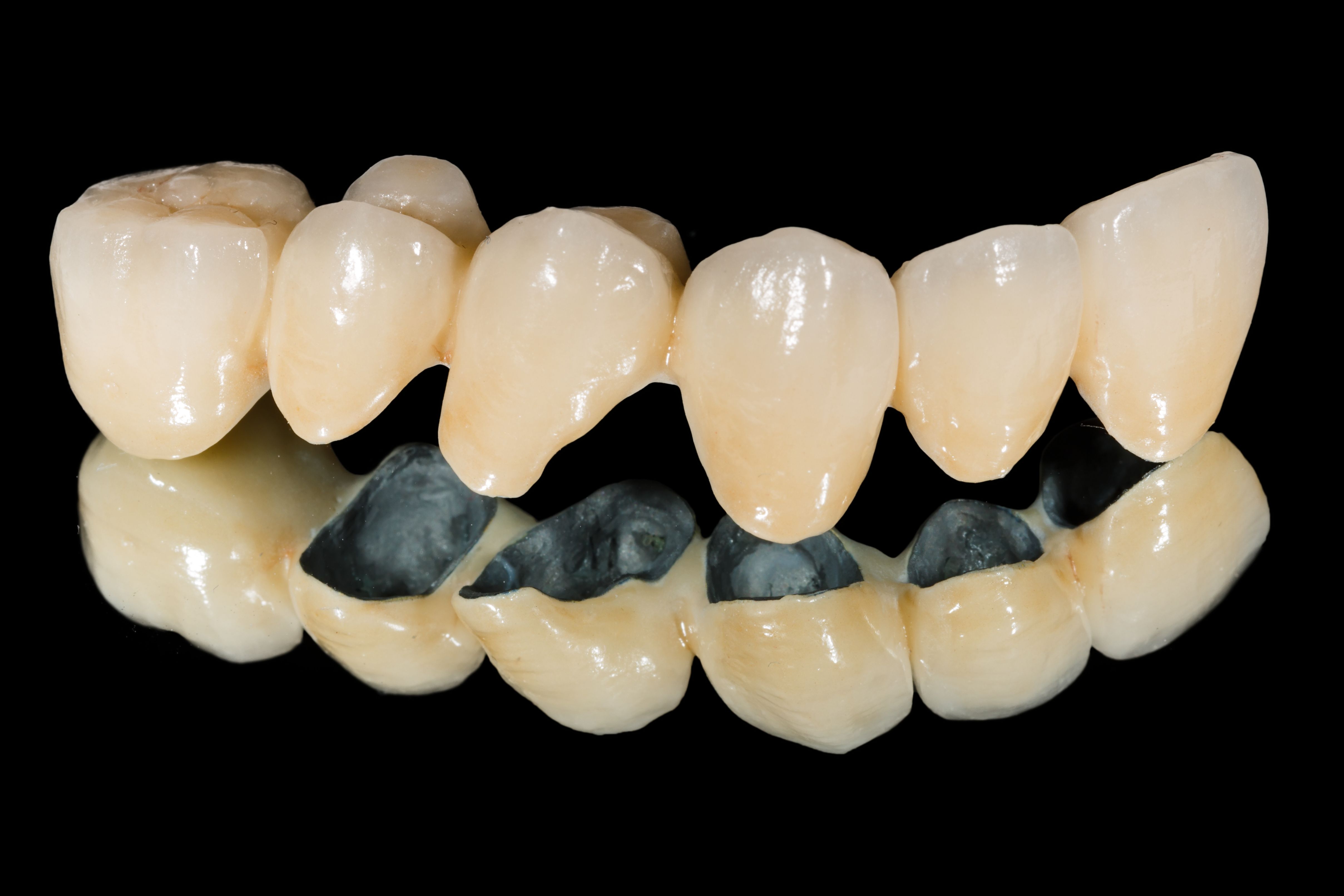 缺几颗牙才能做吸附性义齿?有人说BPS吸附性义齿要拔光牙齿,牙齿修复-8682赴韩整形网