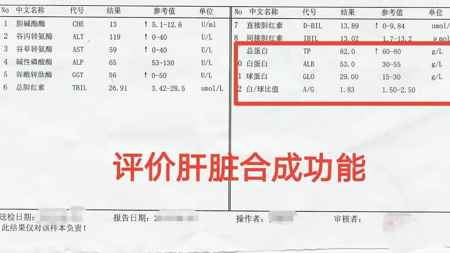 肝功能检查单怎么看？医生：这3个指标正常，说明你的肝脏很健康