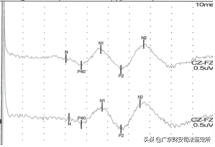 司法鉴定所对高坠伤致头面部损伤的法医临床鉴定
