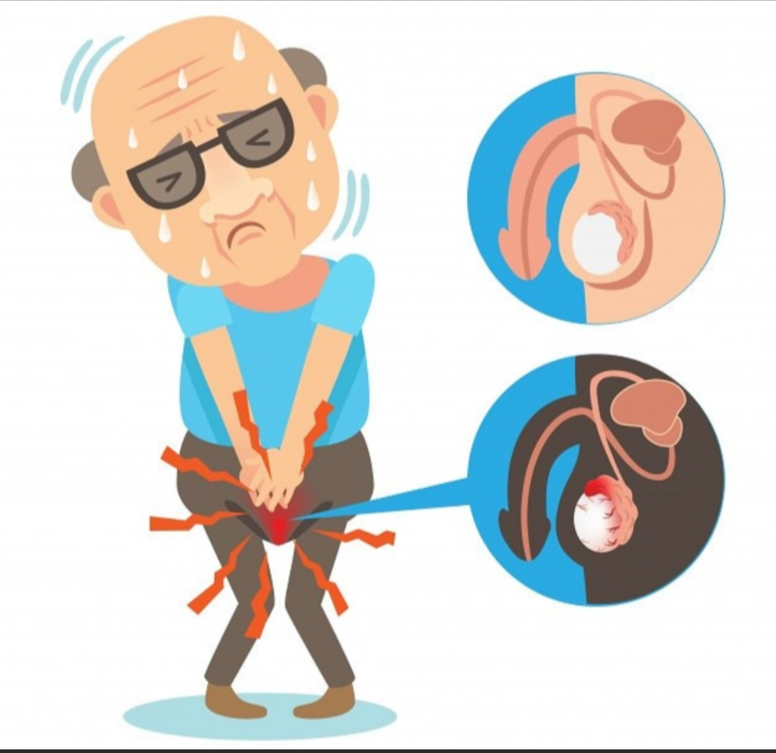 男人40岁以后,如果不想被前列腺增生"盯上",这7种习惯要坚持