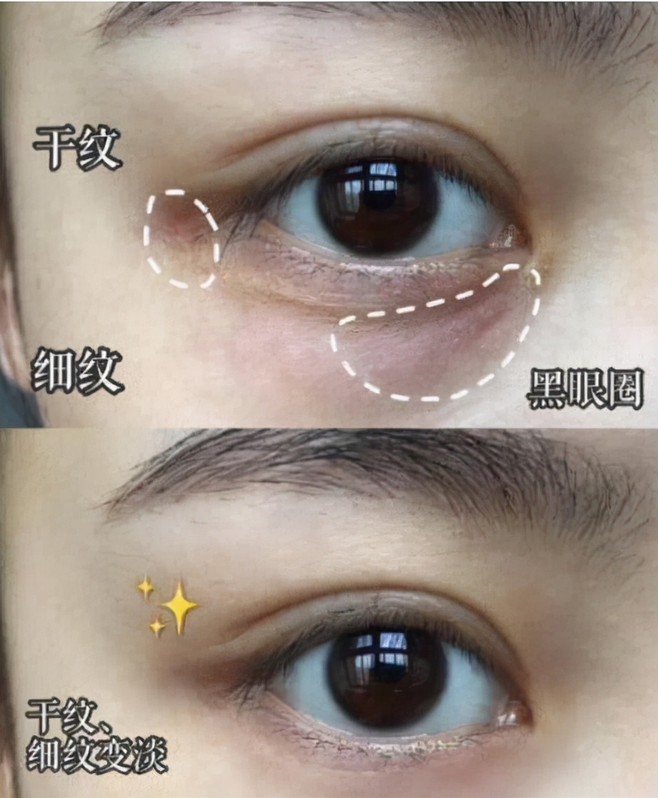 屈臣氏一“实力”眼霜，因价低被误认为街货，但有效淡化黑眼圈