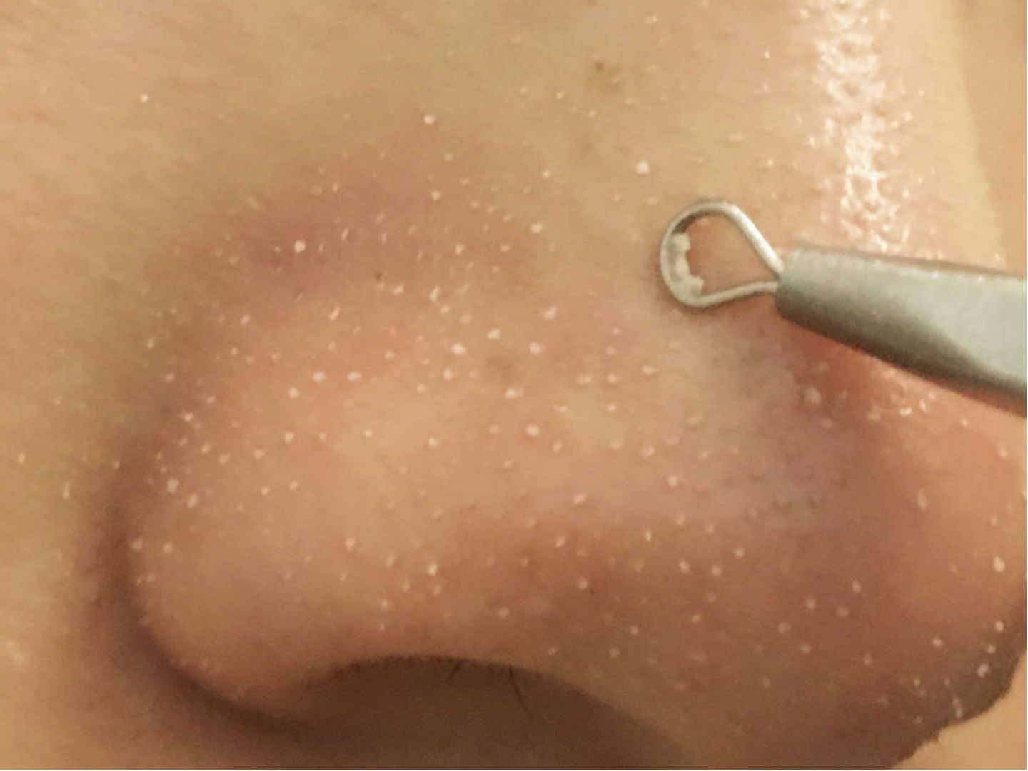 為什么上完粉底液以后，鼻子上有很多白點(diǎn)點(diǎn)？