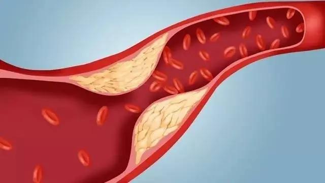 体检查出这19种疾病，医生：其实根本不用治！别再花冤枉钱