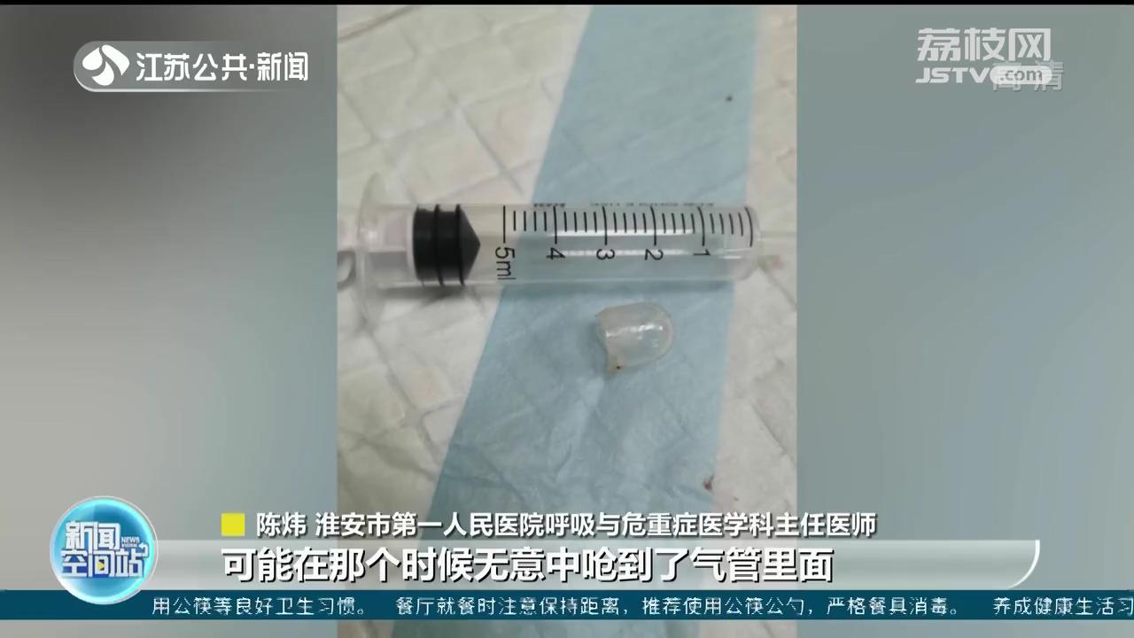 气管里藏瓶塞已经一年 淮安六旬老人肺部反复感染