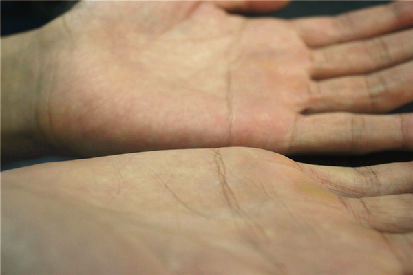 经常头晕，到底是不是因为颈椎病？教您在家2分钟自测，建议收藏