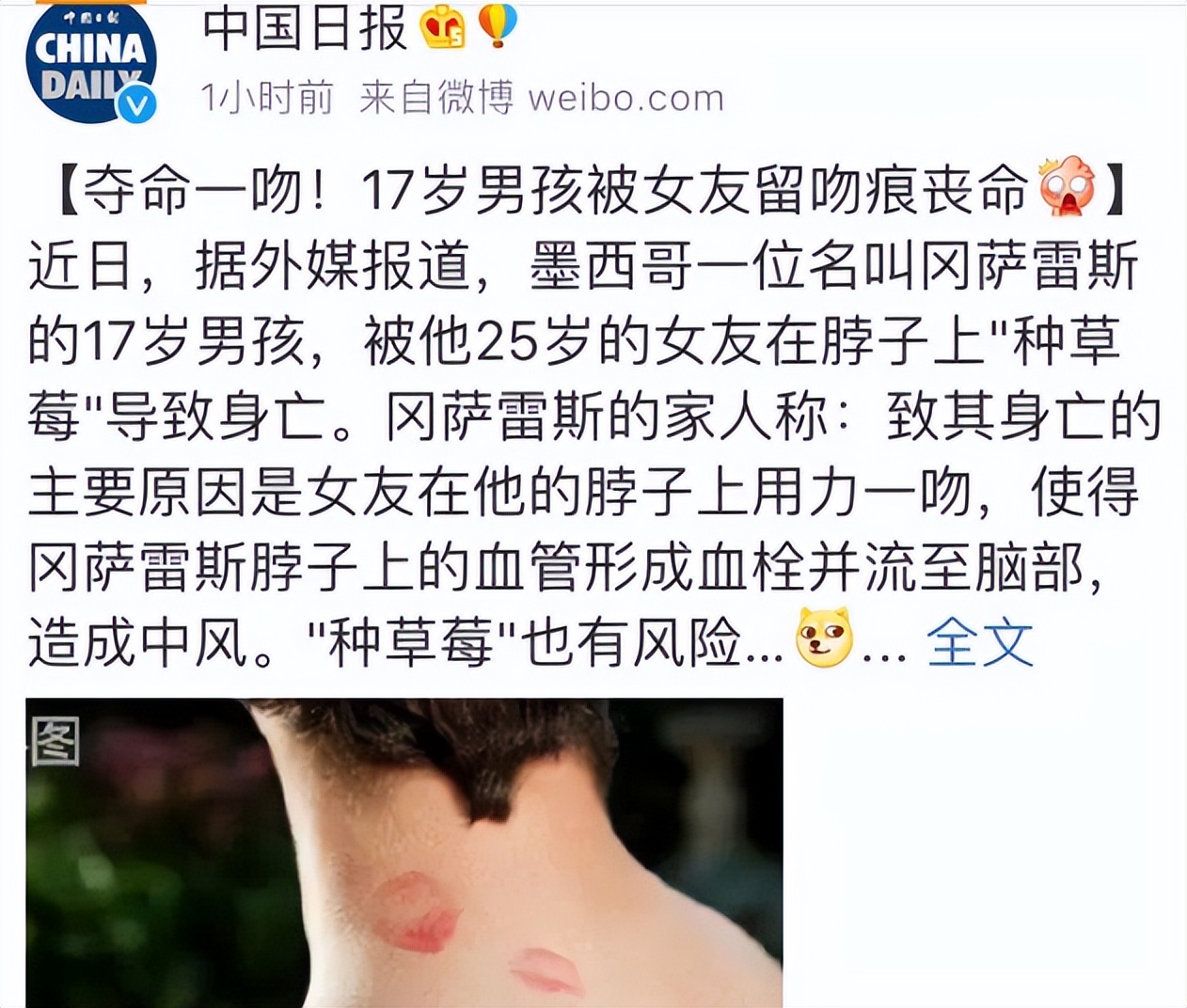 送你一份"种草莓"指南,情侣亲吻这4个地方,不只是更安全