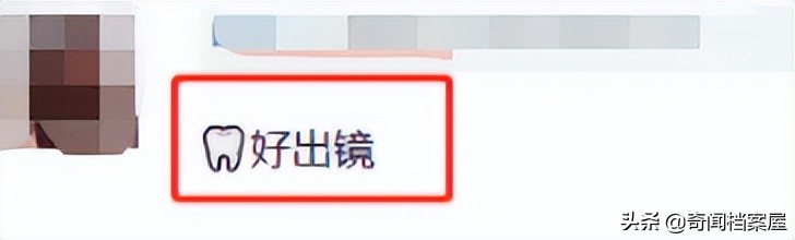 因烤瓷牙扼杀灵气的明星：林允被吐槽、热巴颜值下降，像老了10岁