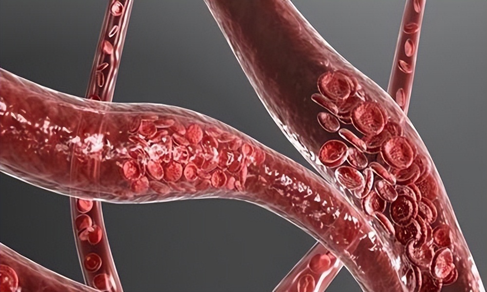 每天晚上坚持勾脚、绷脚，按一按，预防血液粘稠、缓解关节不适