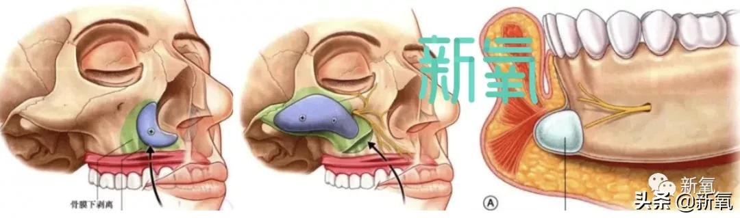 帕德容琶·砂楚(今年43岁的她，年龄仿佛就只是个数字)