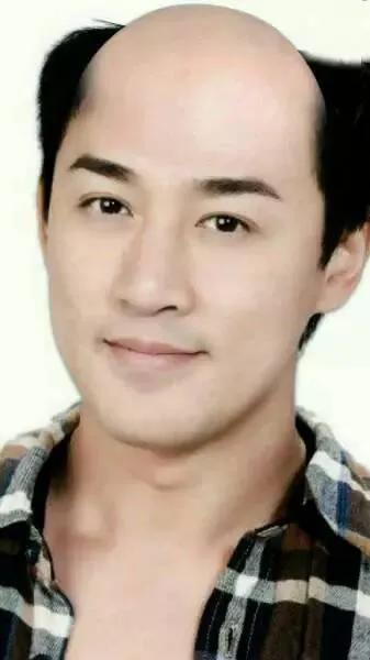 如果明星秃顶了，你还觉得他们帅吗？