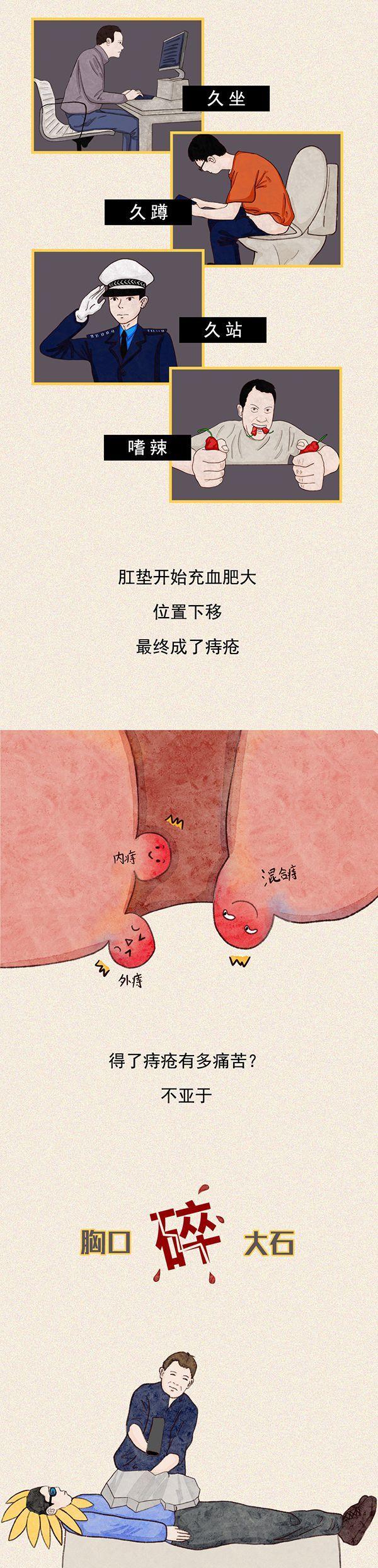 提肛运动的好处有哪些？