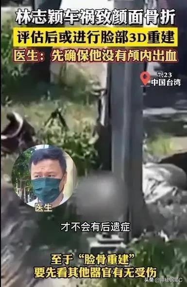 林志颖车祸导颜面骨折，可能毁容？医生称评估后或进行脸部3D重建