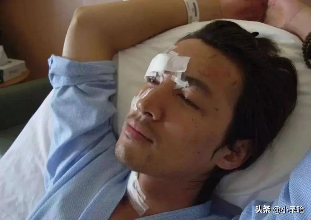 7位因拍戏深受重伤的明星，一位更比一位惨，有的至今没痊愈