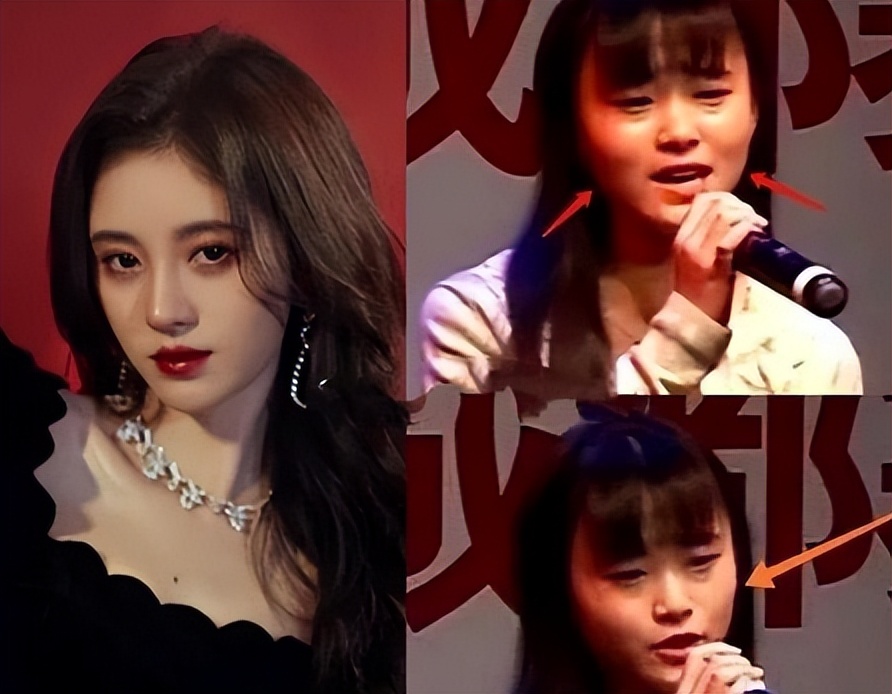 瘦到病态、整容成瘾，痴迷于少女人设，内娱的畸形审美太可怕