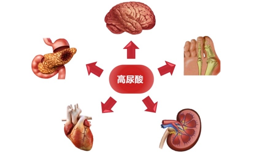 吃非布司他降尿酸记住这4点，不仅尿酸达标，而且副作用很小